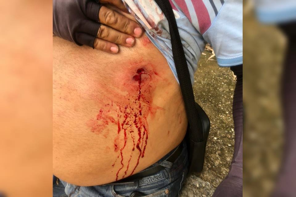 Tiro na barriga
