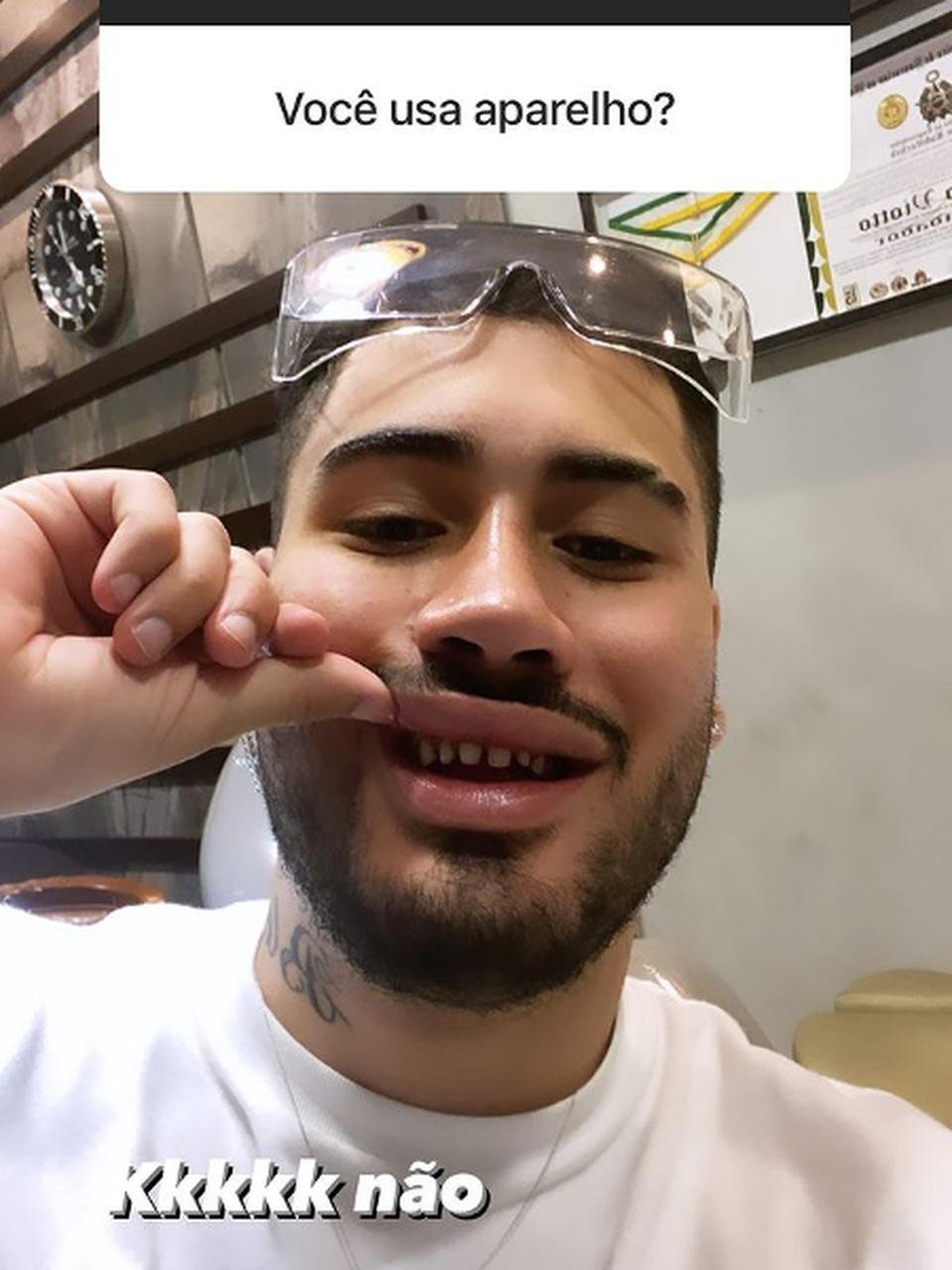 Kevinho Mostra Mais Uma Vez Seus Dentes Desgastados Na Internet