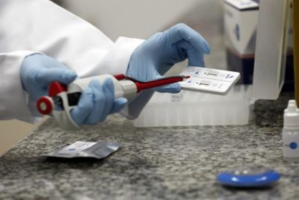 Os testes de Covid comprados pelo GDF estão na mira do TCU