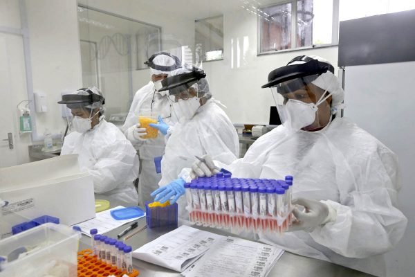 lacen BA laboratorio exame covid teste coronavirus