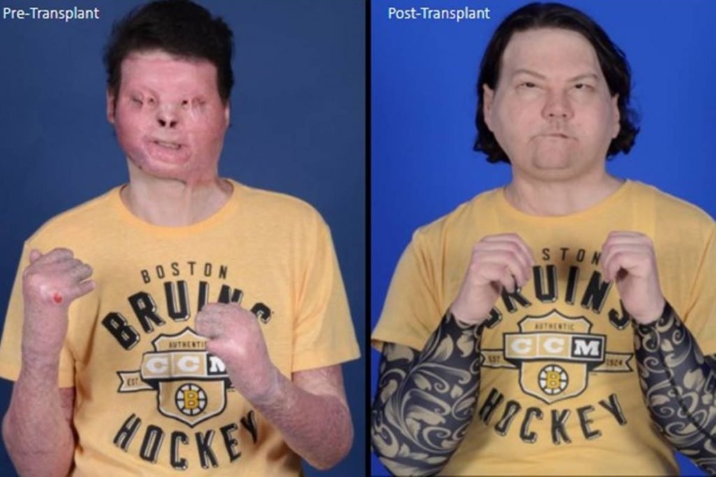 joedimeo antes e depois