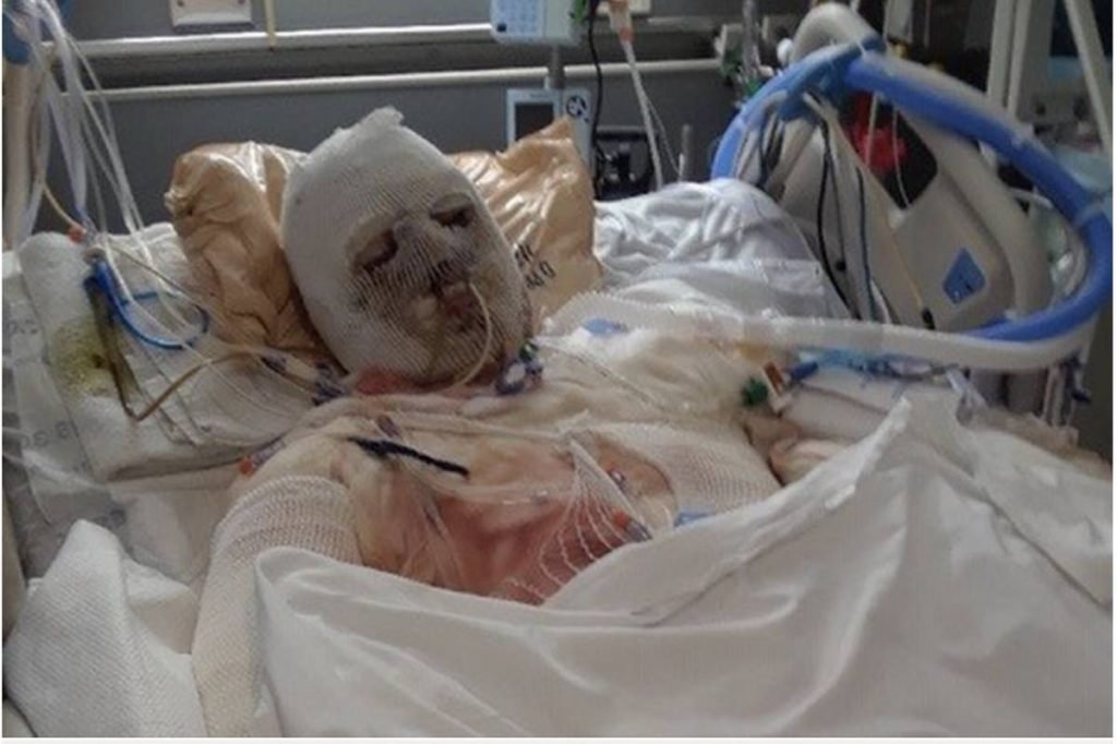 Joe DiMeo hospitalizado
