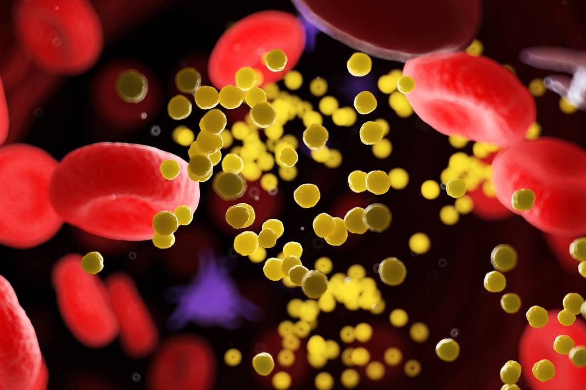 colesterol, gordura no sangue, ilustração
