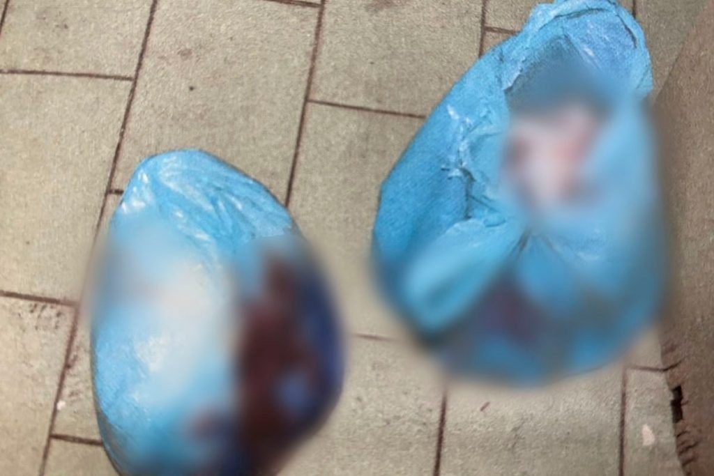 sacolas onde homem foi colocado após ser esquartejado por amigo em Goiânia