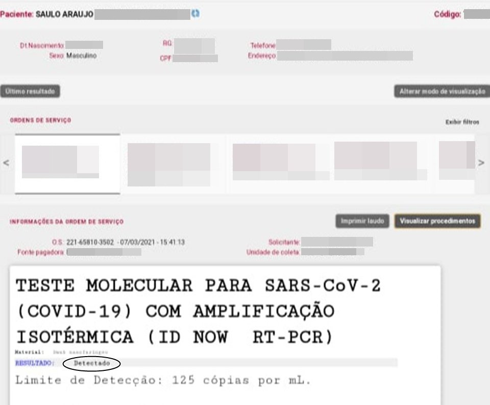 Teste PCR Covid