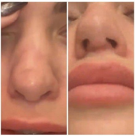 Nariz de Anastasia Balinskaya