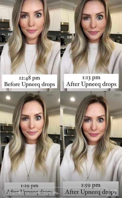 Botox