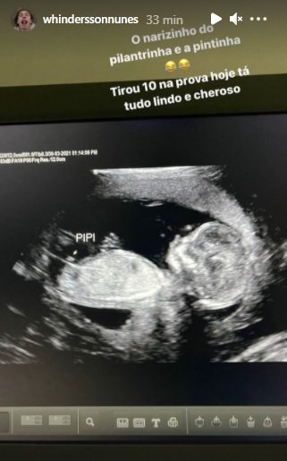 Whindersson ultrassom bebe