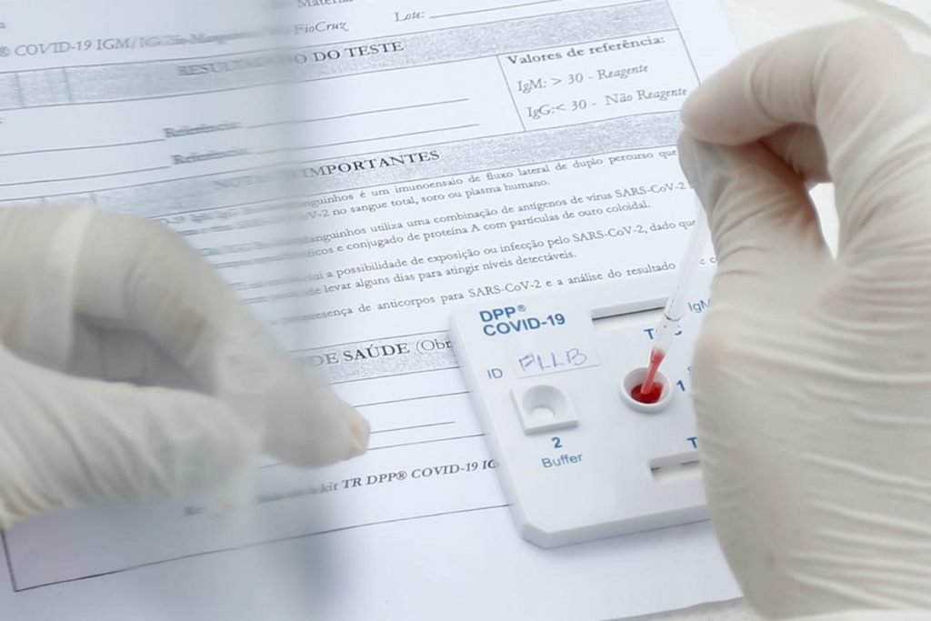 Crianças e adolescentes são testados para CoViD-19 em ação organizada pelo Governo de Goiás
