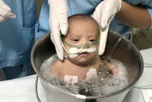 Banho Em Balde Gigante Acalma Bebes Internados No Hospital De Base