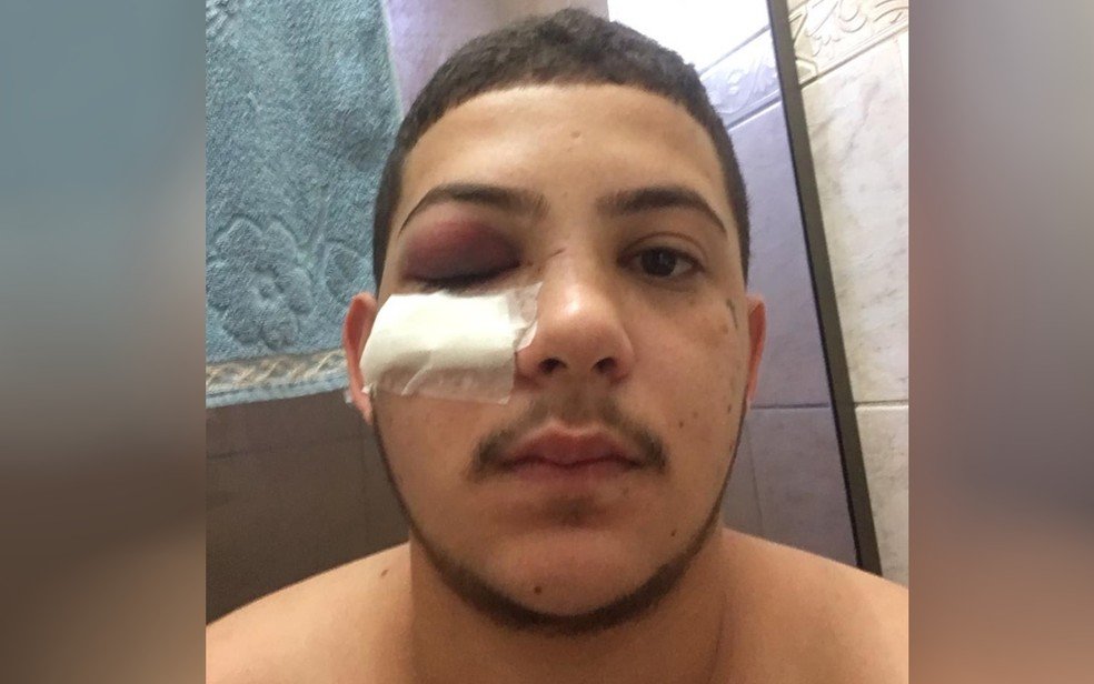 goias jovem diz que foi agredido a socos por cantor sertanejo