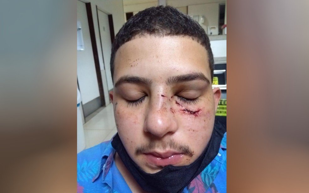 goias jovem diz que foi agredido a socos por cantor sertanejo