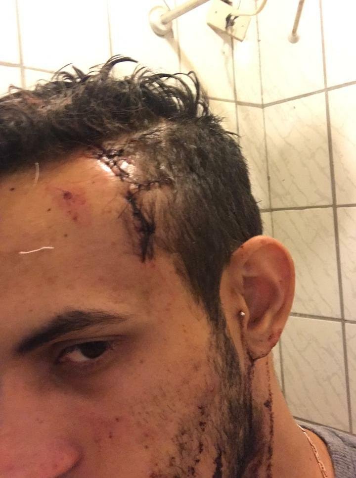 goias jovem agredida registra b.o contra amigo do namorado