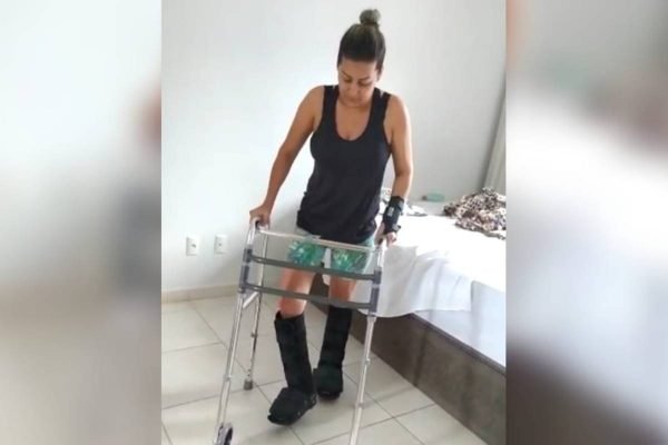 Juliane Lacerda, microempresária que pulou do prédio para fugir de estupro em goiânia volta a andar