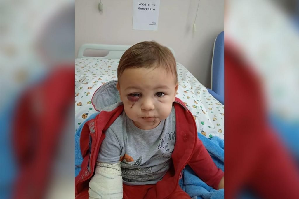 Bebê que sobreviveu à ataque em SC