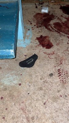 poça de sangue