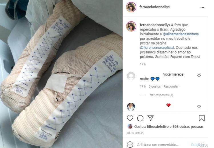 Sapatos de gaze e esparadrapo viralizaram nas redes sociais