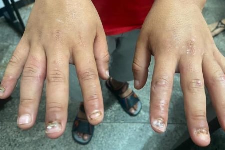 Garoto de 8 anos torturado pelo pai em Goiás