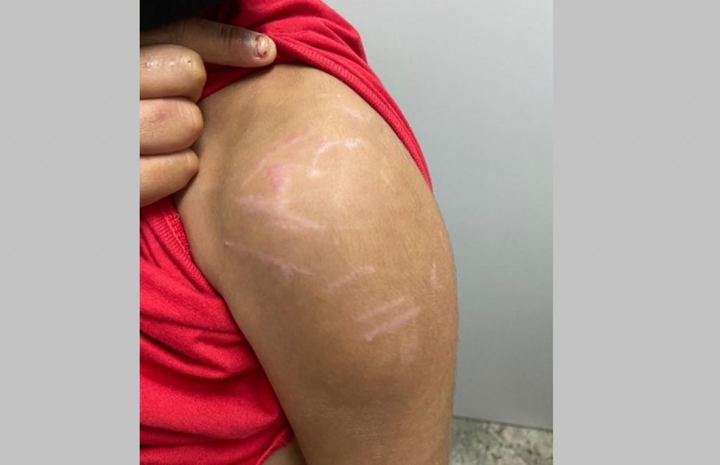 Garoto de 8 anos torturado pelo pai em Goiás