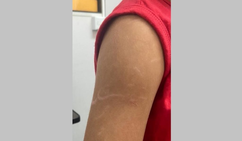 Garoto de 8 anos torturado pelo pai em Goiás