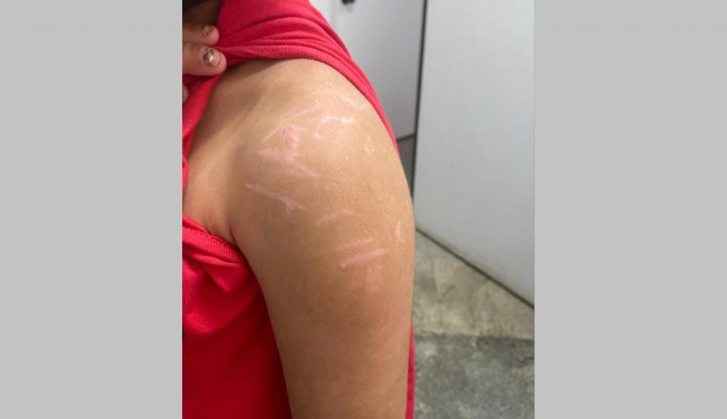 Garoto de 8 anos torturado pelo pai em Goiás