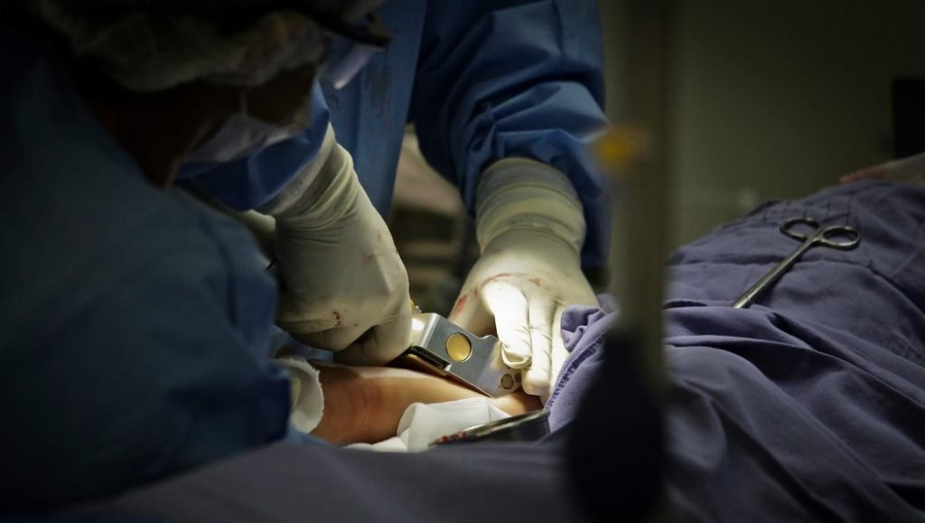 Transplante de pele em criança no Hran