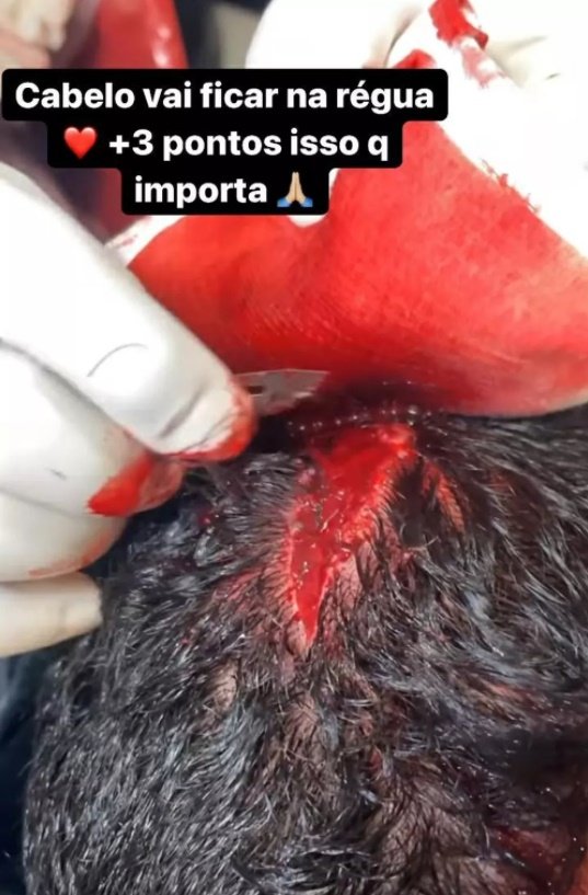 Guilherme Arana corte