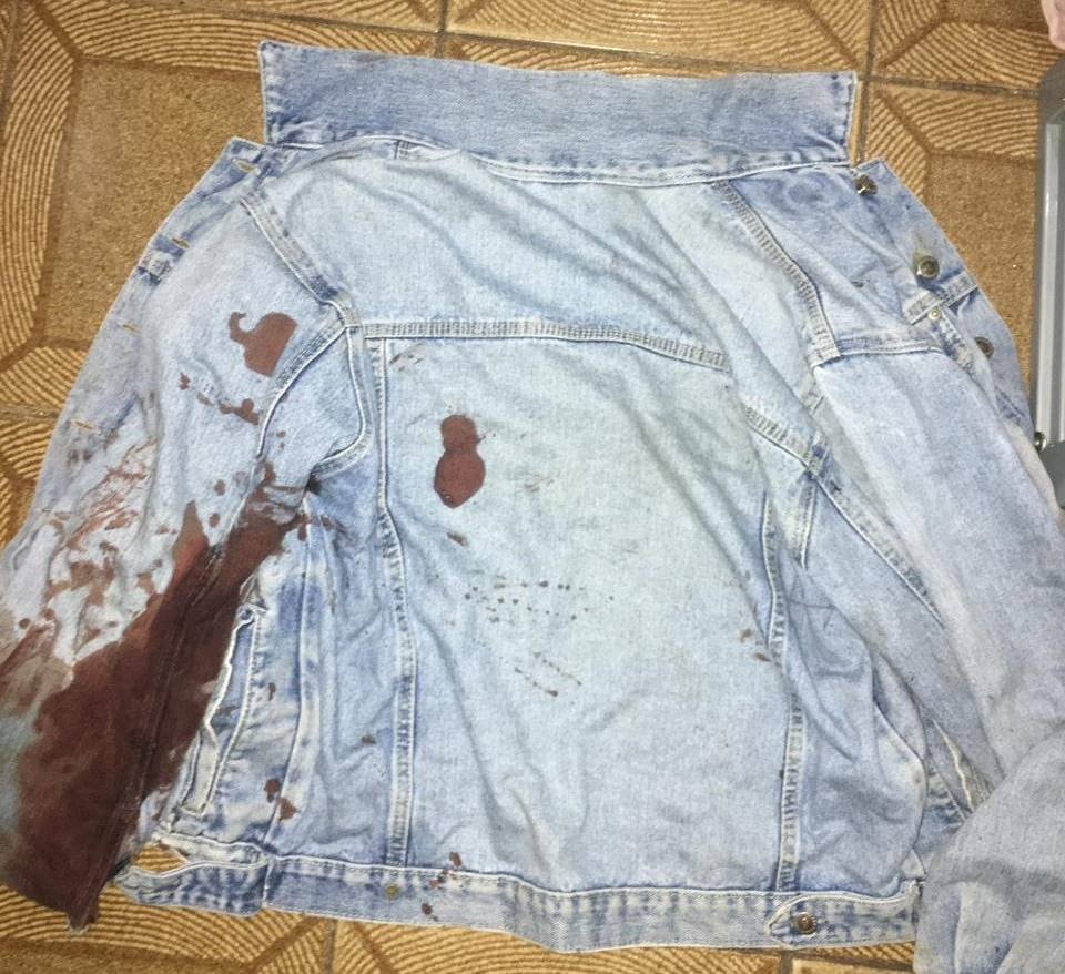Homem é baleado no Metrô-DF