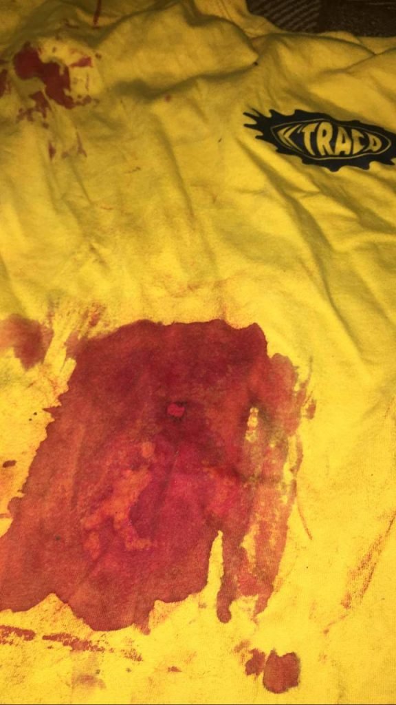 Homem é baleado no Metrô-DF
