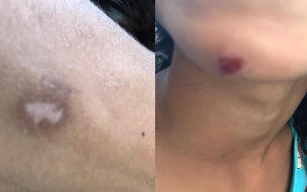 goias crianças pedem socorro apos agressoes do pai