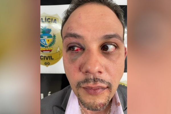 goias advogado agredido por pm