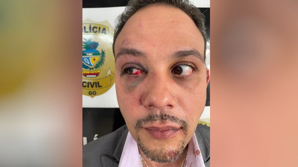 goias advogado agredido por pm