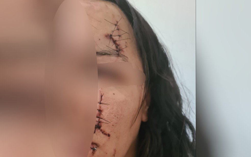 goias prostituta agredida