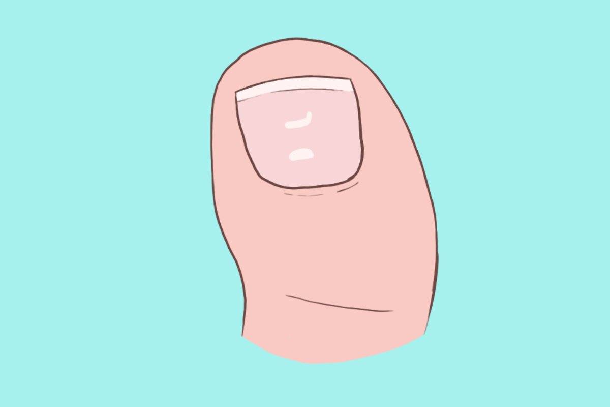 Unhas com manchas brancas