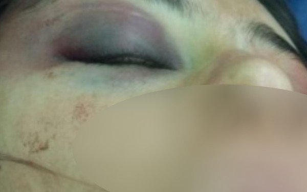 goias mulher espacada pelo marido durante 4 horas