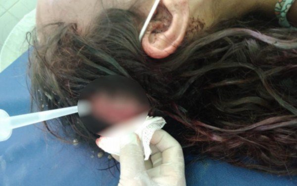 Mulher agredida quatro horas posse goias