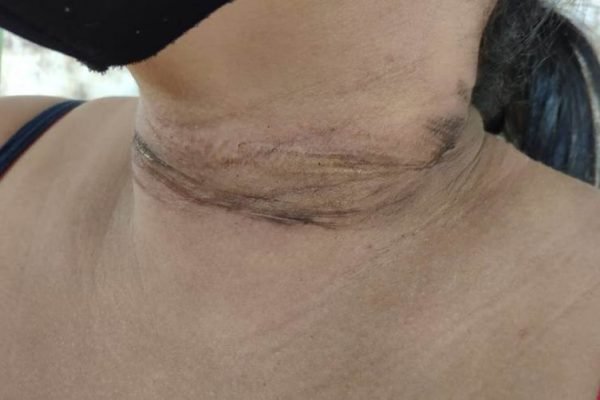goias mulher pescoço ferido fio de internet
