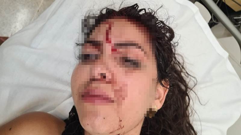 goias jovem agredida festa valparaiso