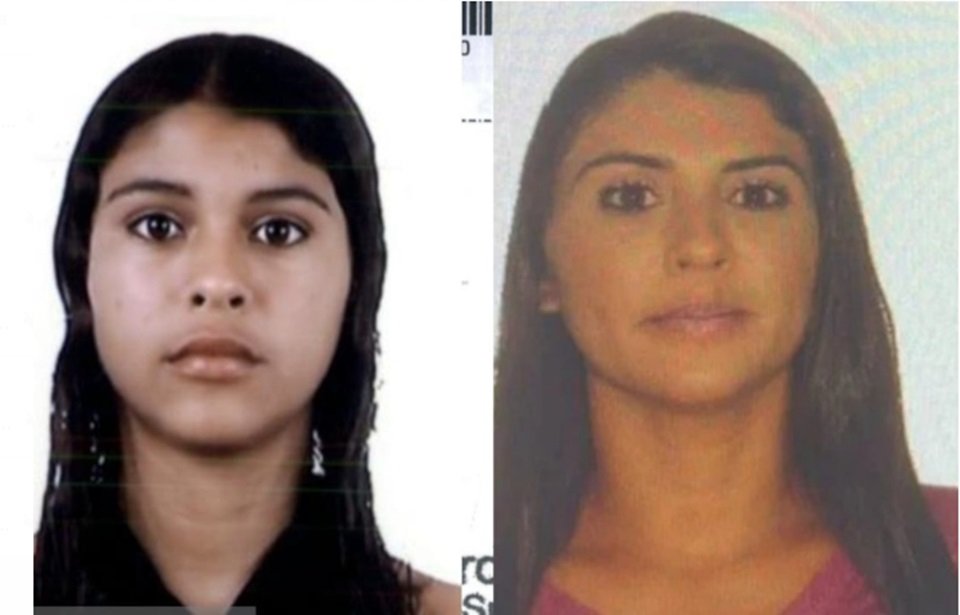 Antes e depois das cirurgias plásticas