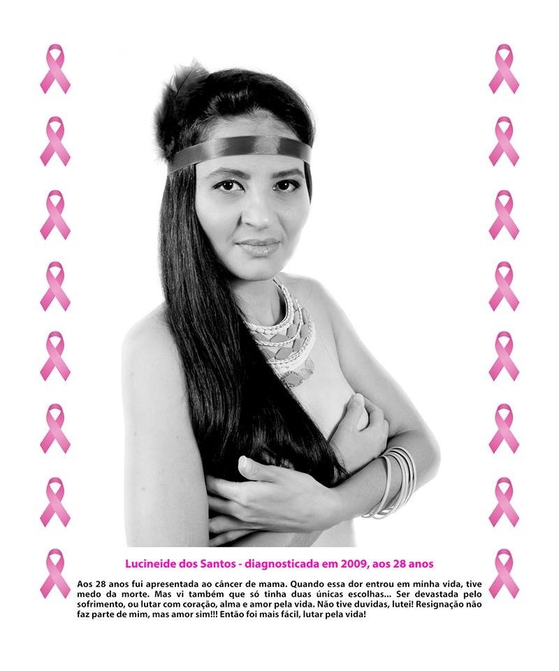 ONG prepara exposição para Outubro Rosa
