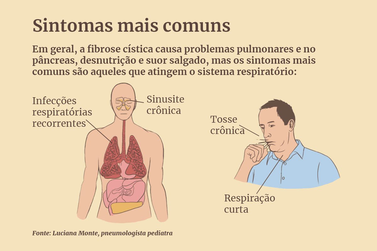 Fibrose Cística, o que é, sintomas e tratamento- Raras com ciência