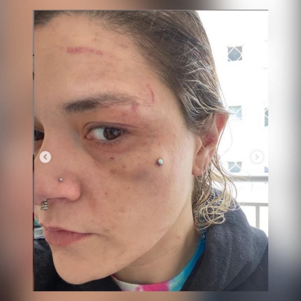 Mayara Calderone, ex-mulher do diretor de bateria da escola de samba Gaviões da Fiel, que foi agredida por ele em SP