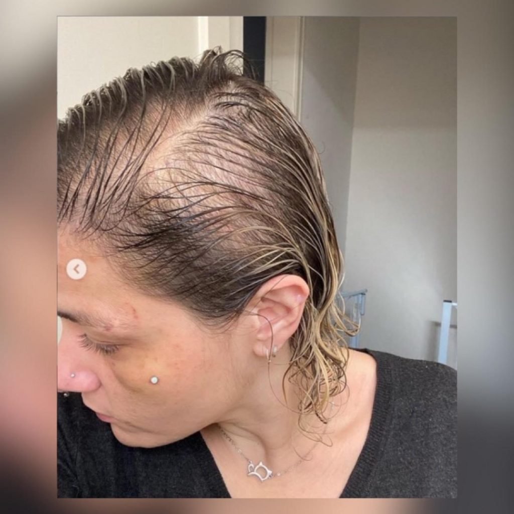 Mayara Calderone, ex-mulher do diretor de bateria da escola de samba Gaviões da Fiel, que foi agredida por ele em SP
