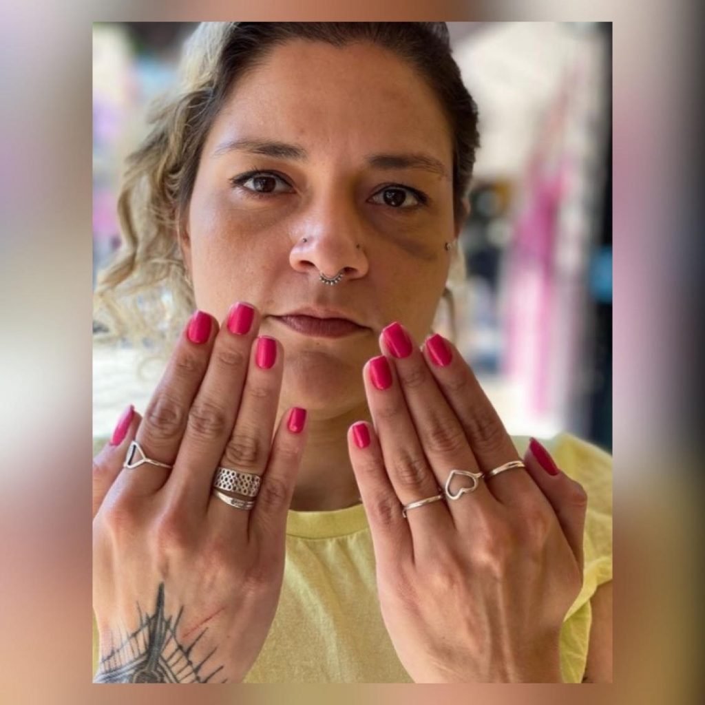 Mayara Calderone, ex-mulher do diretor de bateria da escola de samba Gaviões da Fiel, que foi agredida por ele em SP