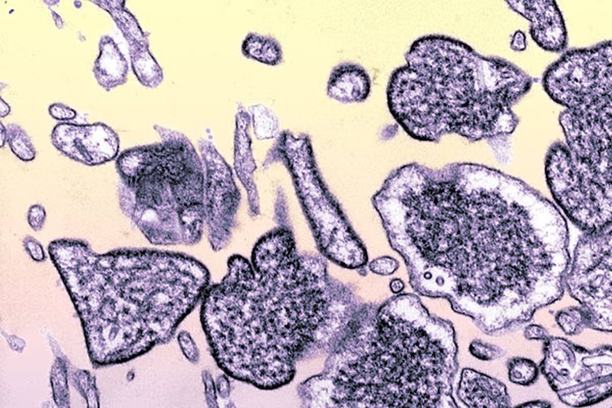 Imagem colorida do vírus nipah visto em microscópio - Metrópoles