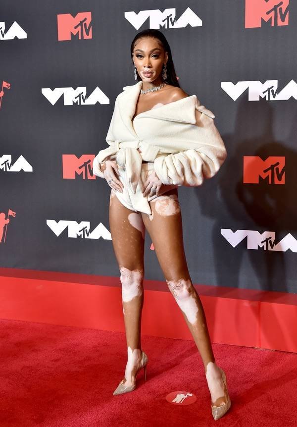 Winnie Harlow