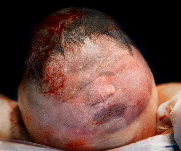 Bebê Noah Gabriel