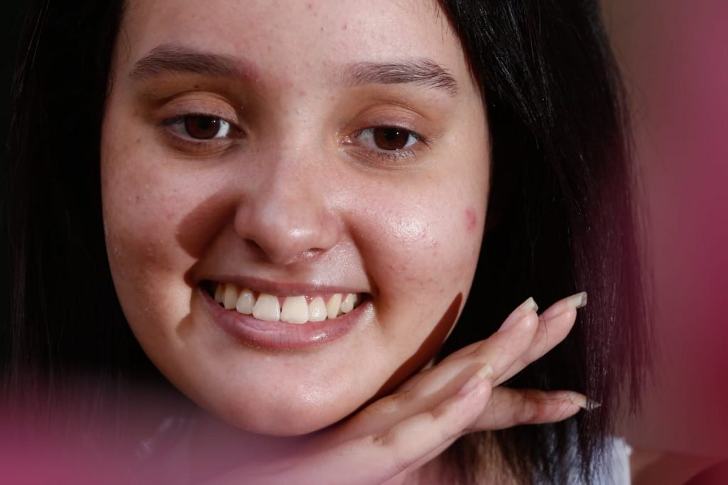 goias garota engasgo com carne