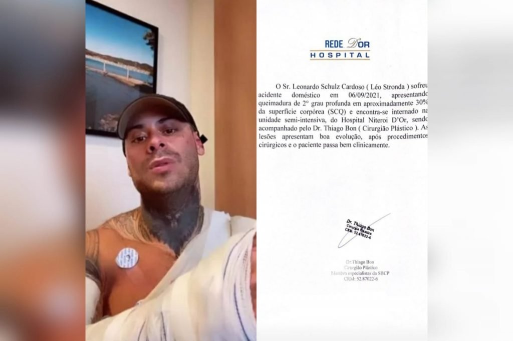 Leo Stronda sofre acidente doméstico