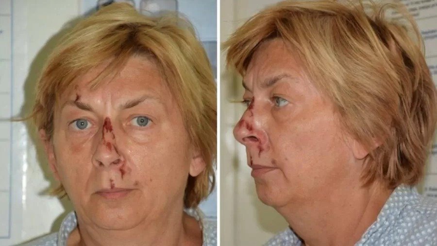 Mulher é encontrada ferida e sem memória em ilha da Croácia